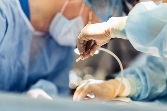 Berbagai Pertimbangan untuk Menunda Operasi Kanker Selama Pandemi COVID-19 - Alodokter