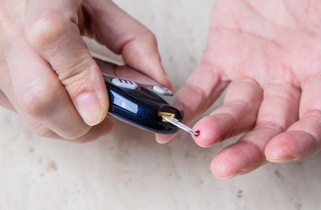 Fungsi Sel Darah Putih dan Gangguan yang Dapat Terjadi - Alodokter