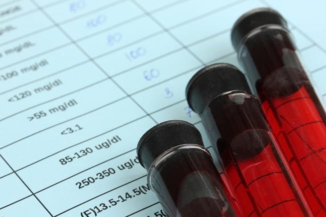 Limfosit Tinggi, Kenali Penyebabnya dan Waspadai Gejalanya - Alodokter