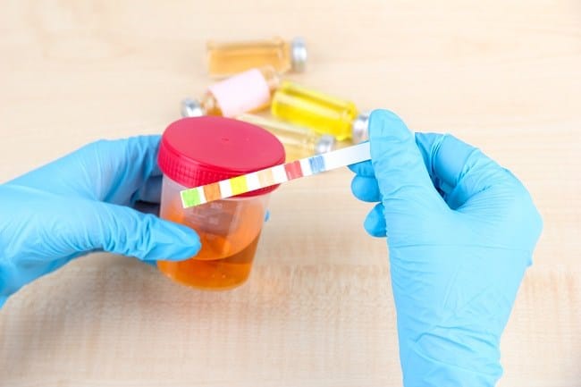 Urinalisis, Ini Hal-Hal yang Perlu Diketahui Sebelum Melakukannya - Alodokter