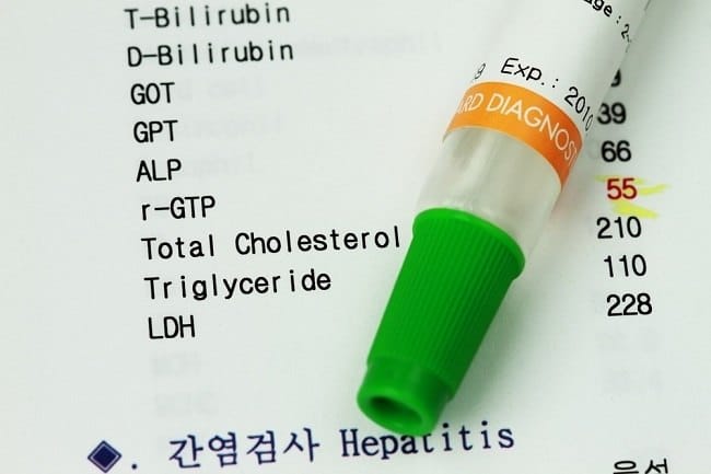 Penyebab Jumlah Bilirubin Meningkat dan Dampaknya bagi Kesehatan - Alodokter