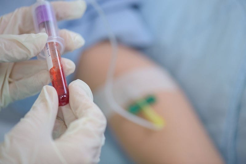 Kenali Gejala Hipovolemia yang Berbahaya dan Penanganannya - Alodokter