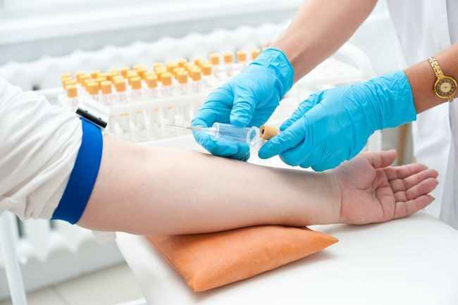 alodokter-trombositopenia