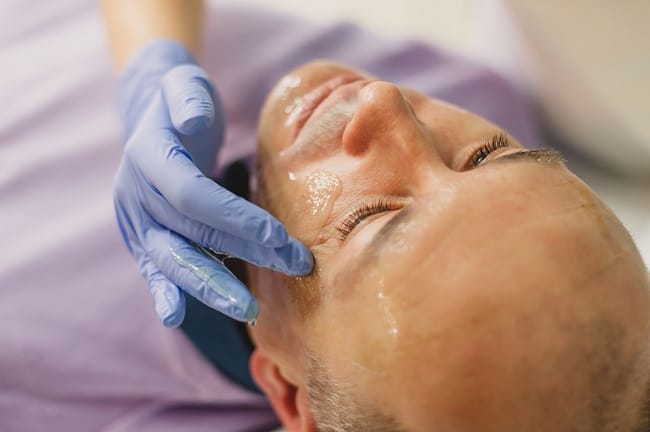 Azelaic Acid - Alodokter