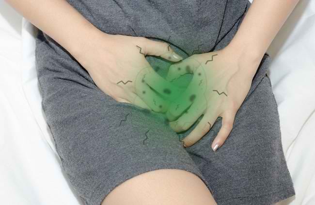 Infeksi Jamur Vagina Beserta Gejala dan Penanganannya - Alodokter