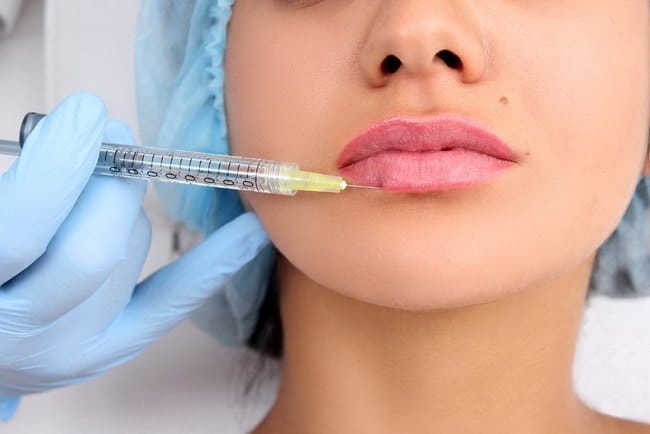 6 Jenis Suntik Filler untuk Kulit Wajah Awet Muda