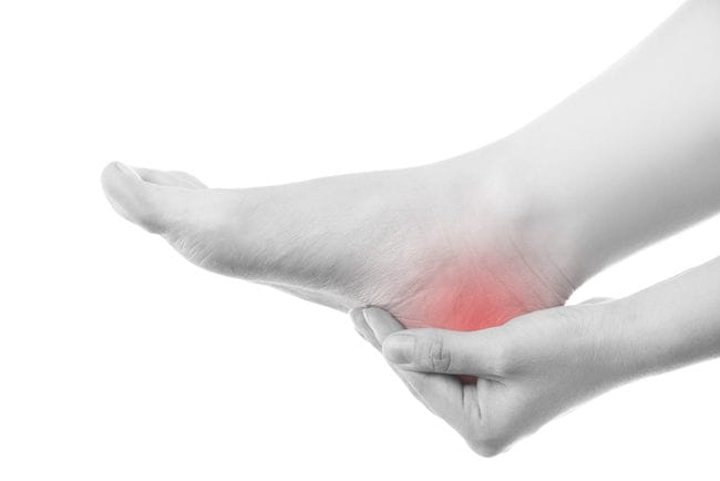 alodokter-plantar-fasciitis
