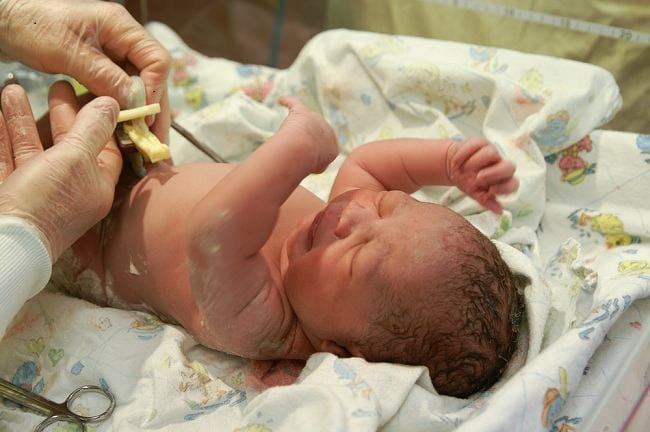 Lotus Birth, Inilah Fakta dan Risiko yang Dapat Terjadi - Alodokter
