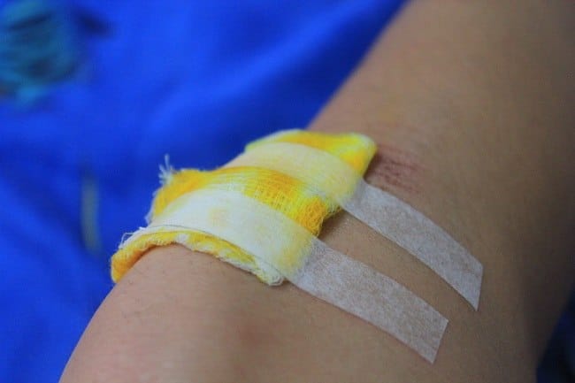 Risiko Luka Robek yang Tidak Dijahit - Alodokter