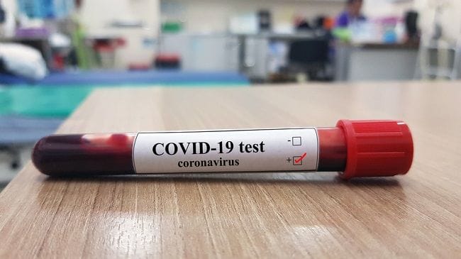 Cari Tahu Penjelasan tentang Rapid Test COVID-19 Positif di Sini - Alodokter