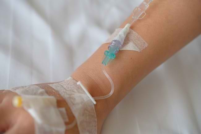 Mengenal Parenteral, Metode Pemberian Nutrisi dan Obat dari Pembuluh Darah - Alodokter