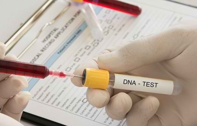Tes DNA, Ketahui Beragam Jenis dan Manfaatnya - Alodokter