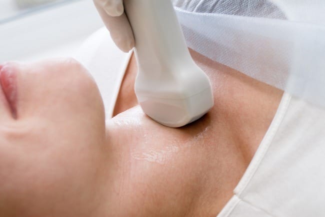 Graves' Disease - alodokter