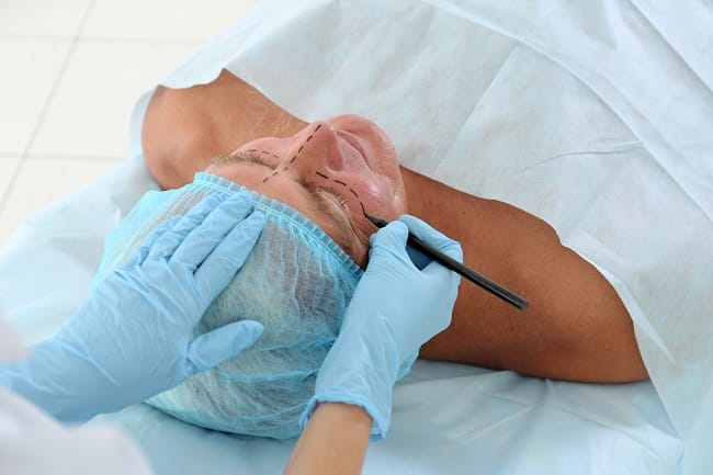 Operasi Kantung Mata: Persiapan, Proses, dan Pemulihan - Alodokter