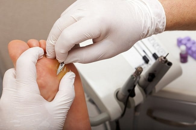 formaldehyde - alodokter