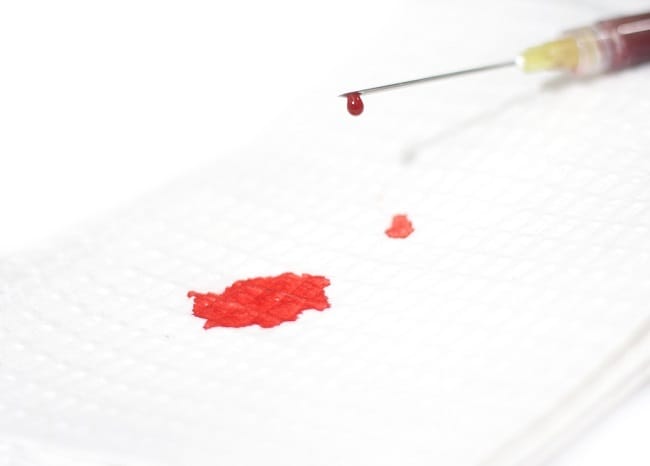 Mengenal Phobia Darah dan Penanganannya - Alodokter