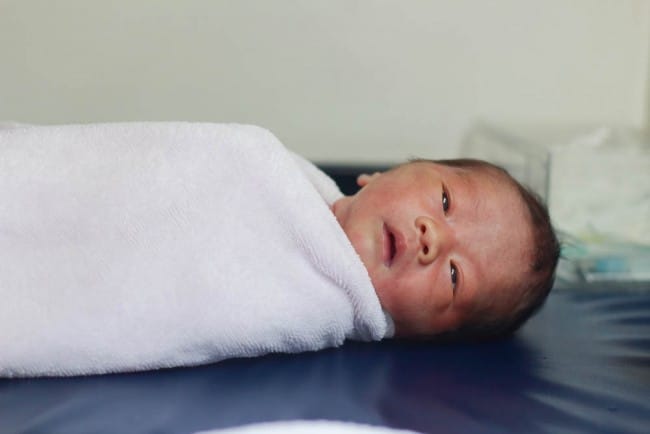 Sindrom Eisenmenger - Alodokter