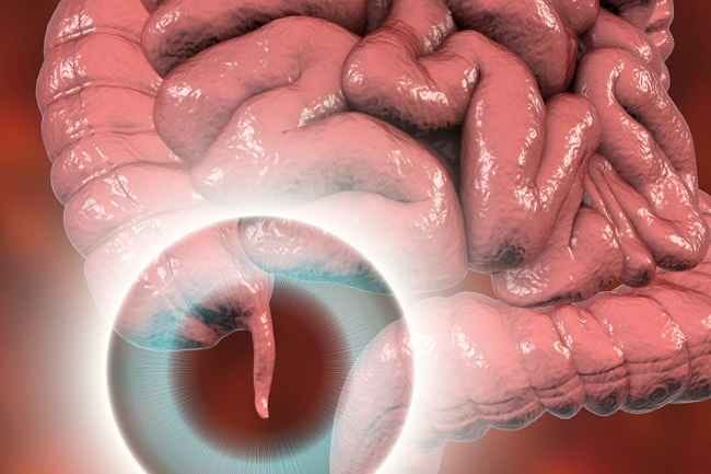 Fungsi Usus Buntu yang Jarang Diketahui - Alodokter