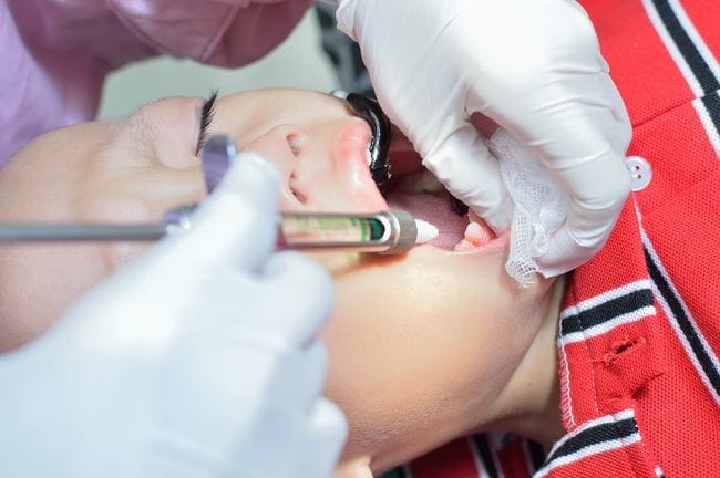 Cabut Gigi, Kenali Berbagai Kondisi yang Mendasarinya - Alodokter