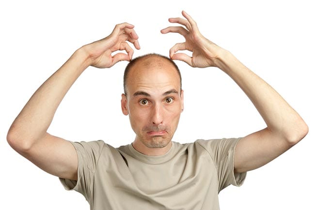 Minoxidil - Alodokter