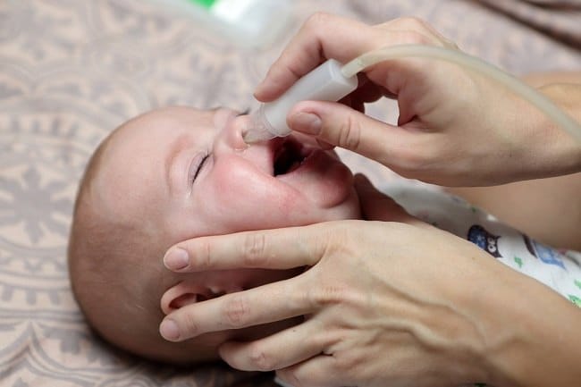 Mengatasi Hidung Tersumbat pada Bayi, Inilah 5 Cara Mudah Melakukannya - Alodokter