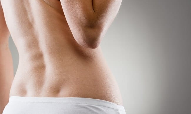 Osteopetrosis - alodokter