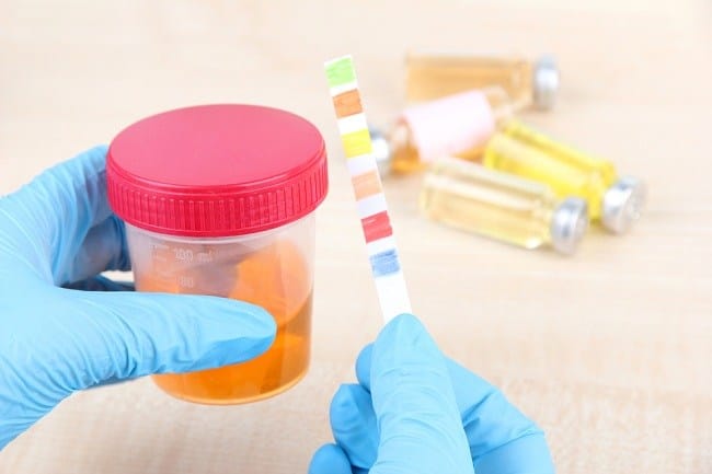 Waspadai Protein Urine Berlebih pada Anak dan Ibu Hamil - Alodokter