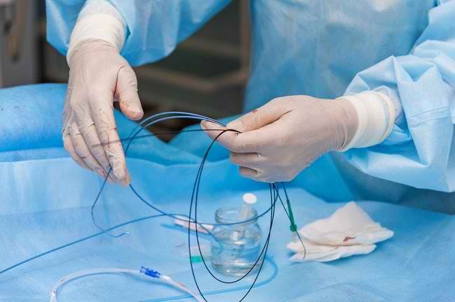 Angioplasti, Penyelamat Nyawa Pengidap Sakit Jantung - Alodokter