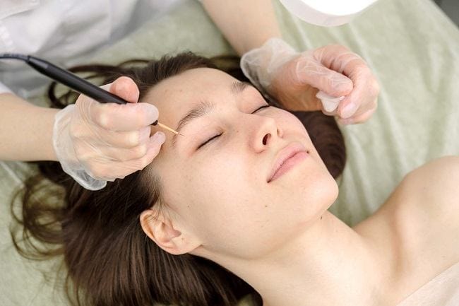 Jangan Salah! Kauter Beda dengan Laser - Alodokter