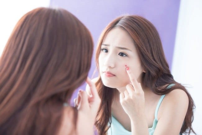 Jerawat Meradang, Inilah 6 Cara Efektif untuk Mengatasinya - Alodokter