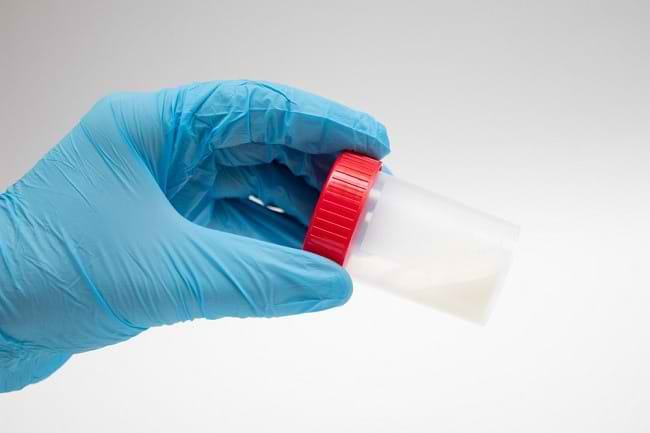 Air Mani Encer, Kenali Penyebab dan Tips Mengatasinya - Alodokter