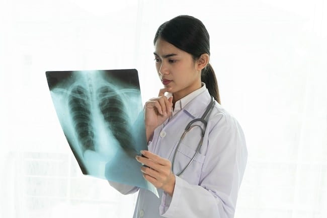 Abses Paru - Alodokter