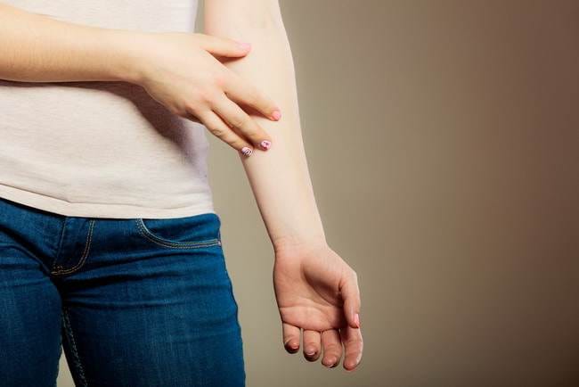 4 Jenis Salep Eksim untuk Mengatasi Masalah Kulit - Alodokter