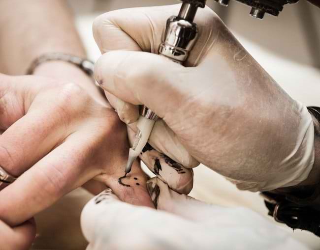 Manfaatkan Sinar Laser untuk Menghapus Tato - Alodokter