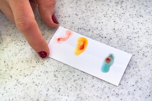 Informasi Seputar Tes Golongan Darah dan Fungsinya - Alodokter