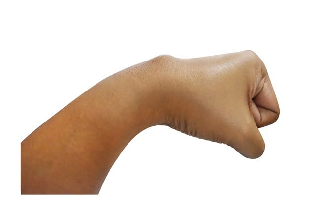 Jenis-Jenis Penyakit Kista pada Pria - Alodokter