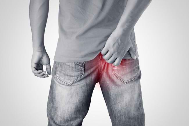 Anus Gatal Dapat Diatasi Melalui Perawatan di Rumah - Alodokter