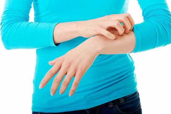 Solar Urticaria: Penyebab, Gejala, Pengobatan, dan Cara Mencegahnya - Alodokter