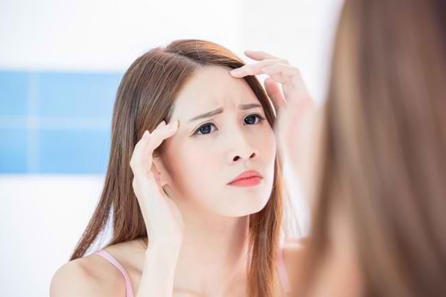 Cara Menghilangkan Kerutan di Dahi dan Mencegah Kemunculannya - Alodokter
