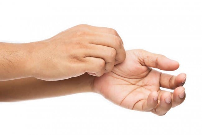 Cutaneous Larva Migrans - Alodokter