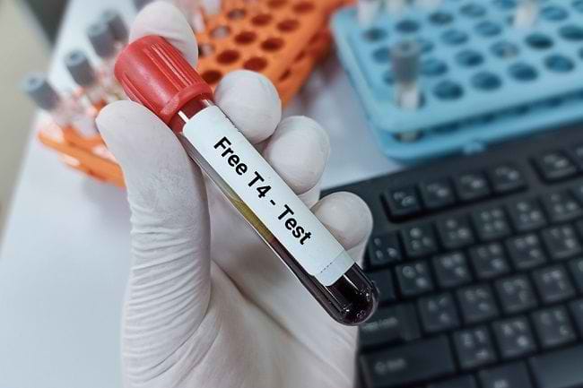 Ketahui Seputar FT4, Pemeriksaan untuk Tiroid - Alodokter