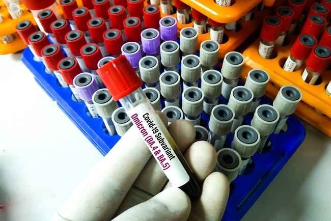 Mengenal Subvarian Omicron BA.5 - Alodokter