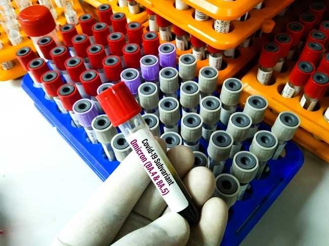 Mengenal Subvarian Omicron BA.4 - Alodokter