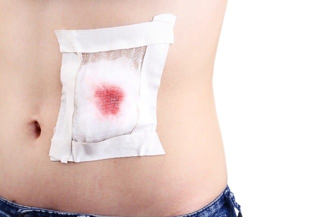 Memahami Trauma Abdomen dan Cara Penanganannya - Alodokter