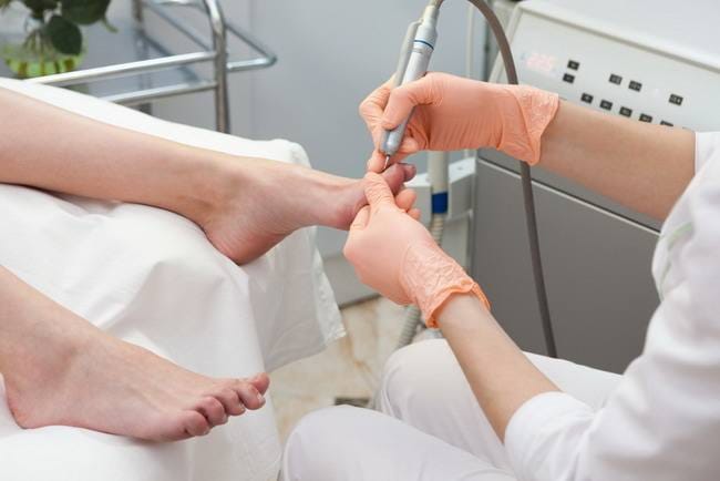 Ketahui Penyebab dan Cara Mengatasi Cantengan Jempol Kaki - Alodokter