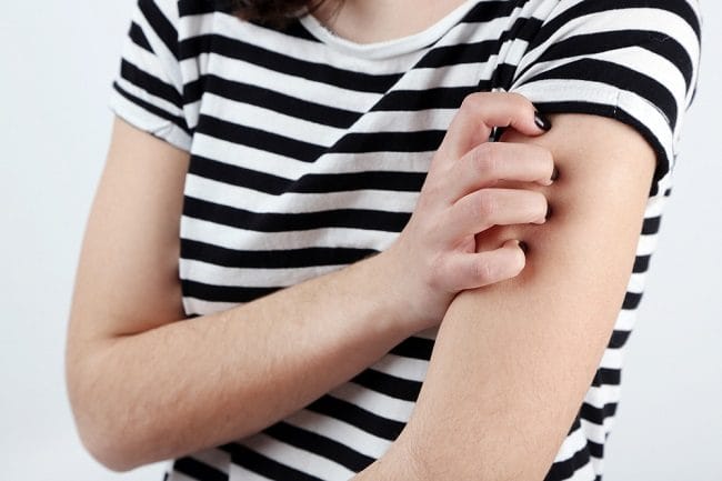 5 Obat Gatal Alergi yang Efektif - Alodokter