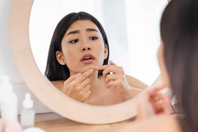 Kenali Berbagai Penyebab Munculnya Jerawat di Wajah - Alodokter