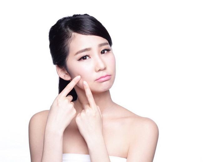 Kenali Hormon Penyebab Jerawat dan Cara Menanganinya - Alodokter