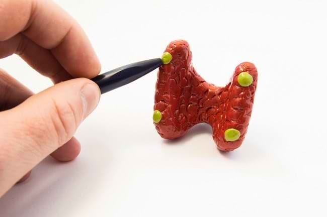 Kelenjar Paratiroid, Ketahui Fungsi dan Gangguan yang Bisa Memengaruhinya - Alodokter