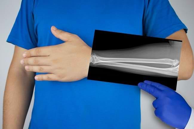 Mengenal Fungsi Tulang Hasta dan Gangguan yang Dapat Terjadi - Alodokter